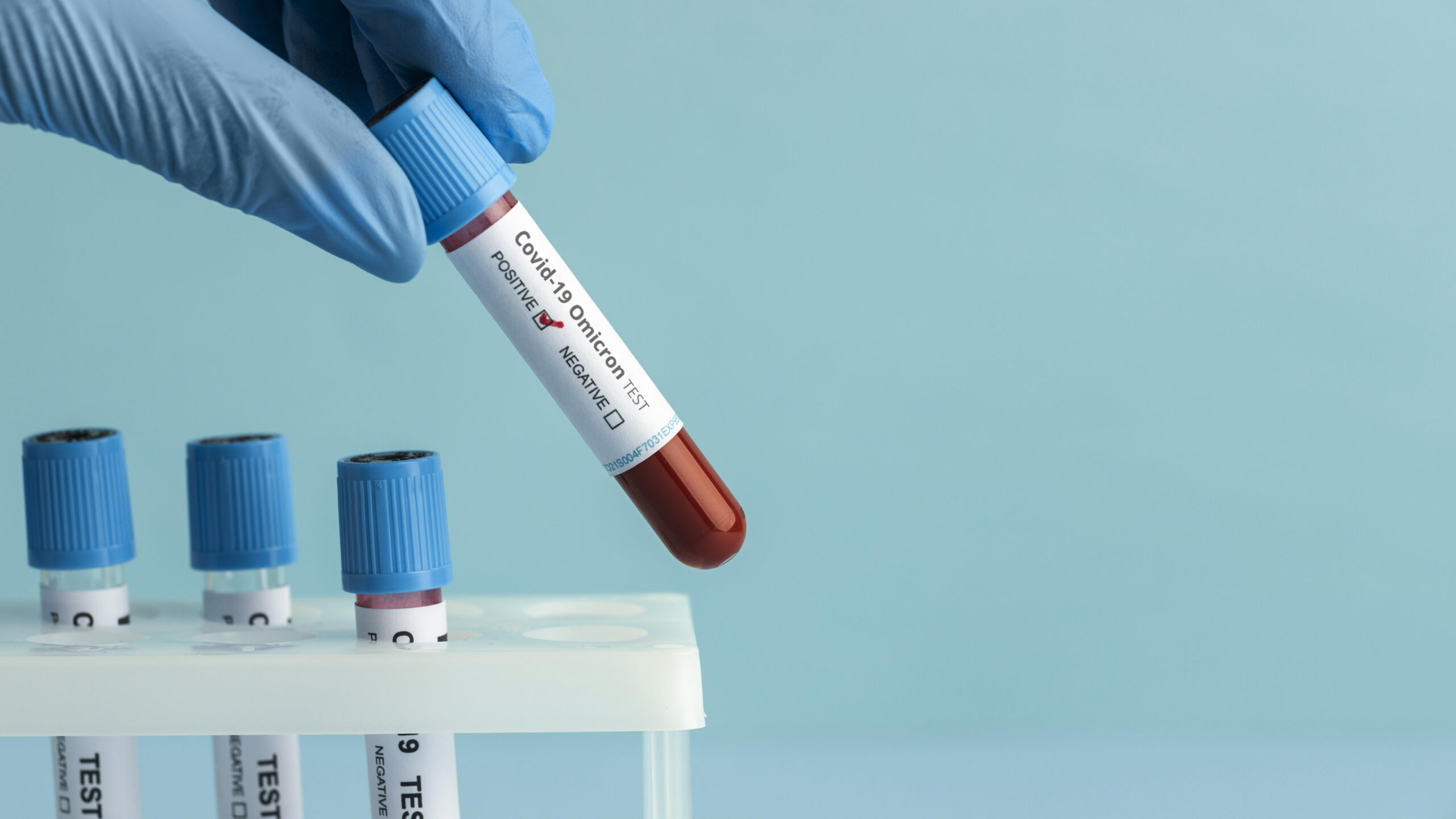 close-up-on-blood-test-for-omicron(1)